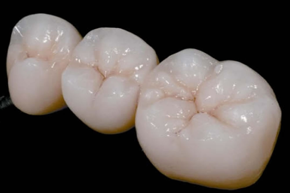 歯の特徴