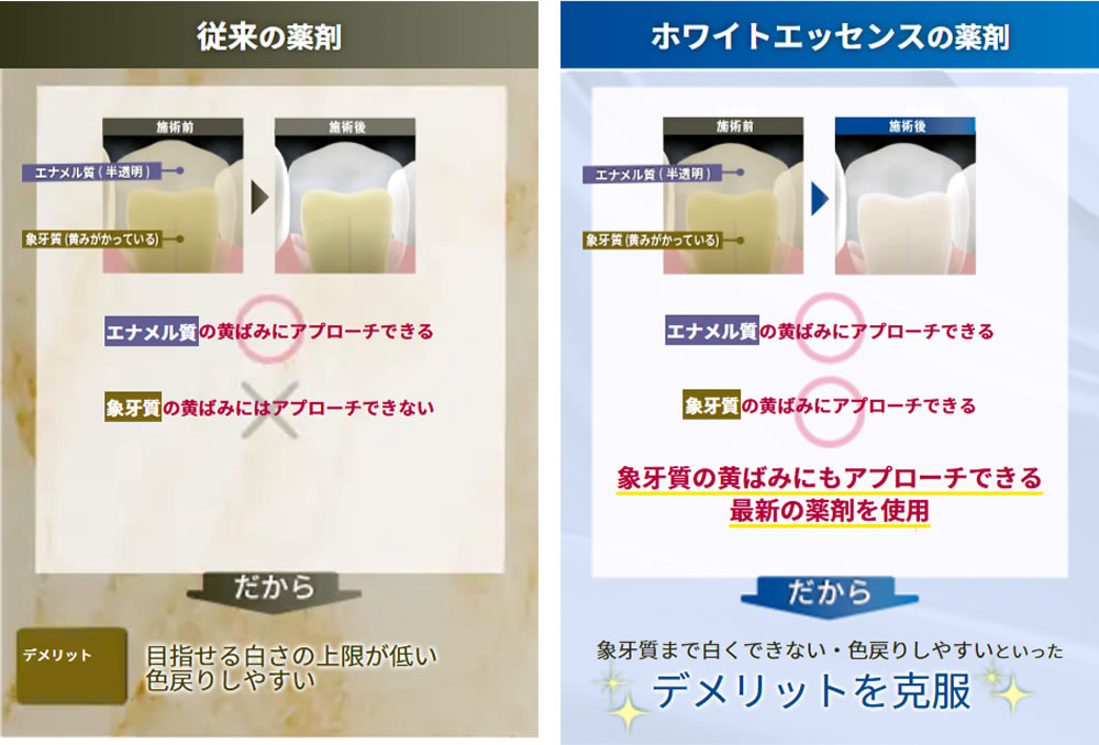 従来の薬剤とホワイトエッセンスの薬剤の違い